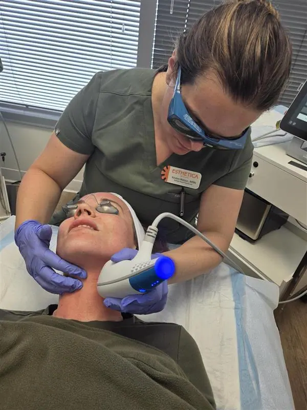 A Clear + Brilliant laser facial in progress